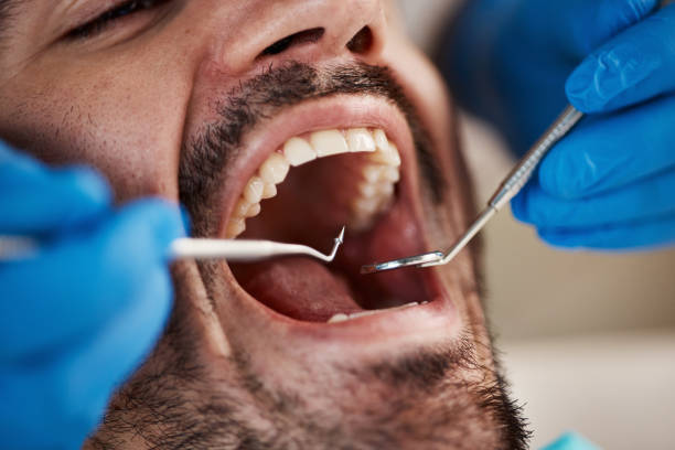 Best Broken or Cracked Tooth Emergency Dentist in Pato, WA